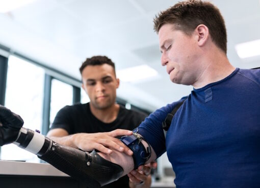 Vollfunktionsfähige Armprothese